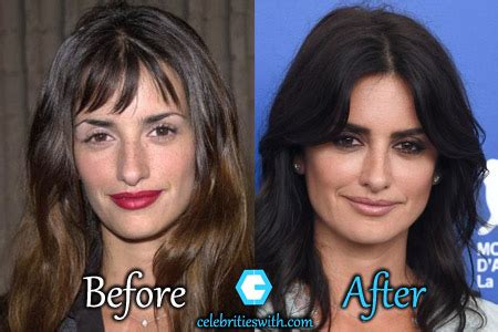 Penelope Cruz Before and After Plastic Surgery: Boob, Nose, Face.